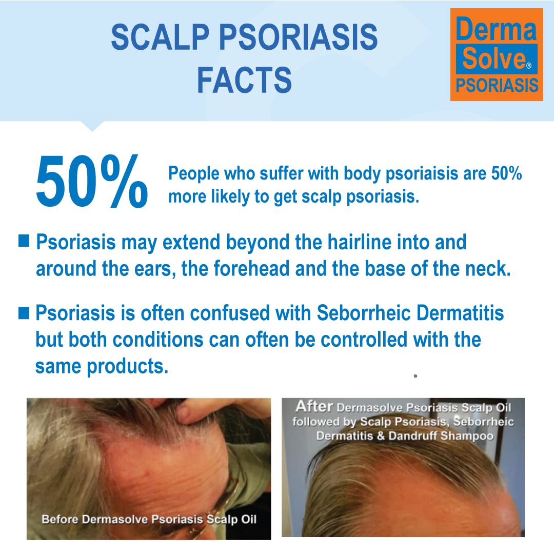 Champú para la psoriasis y acondicionador en aerosol