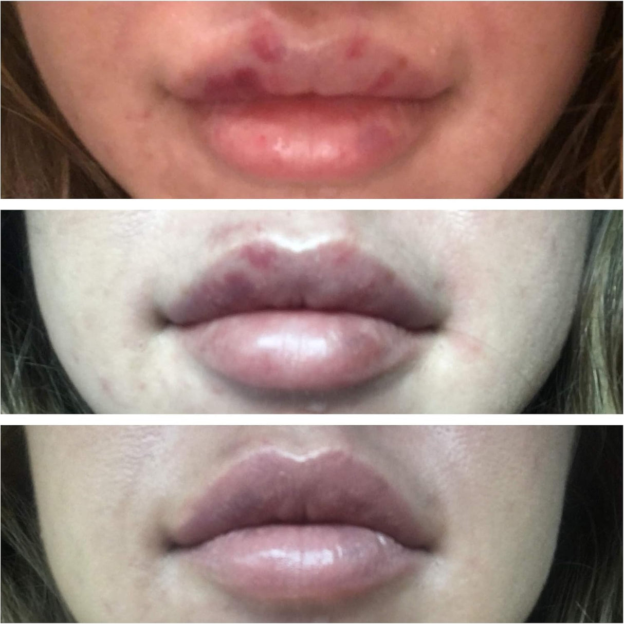 Suplementos Alimenticios de árnicapara moretones e hinchazón