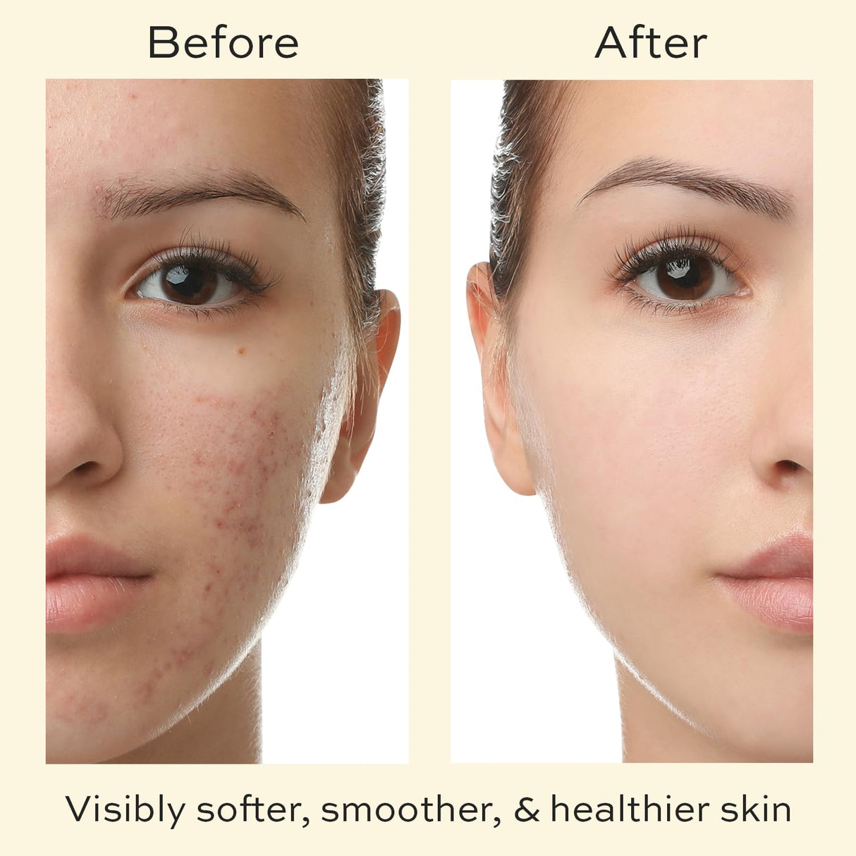 Crema facial para mujeres hombres y adolescentes The Natural