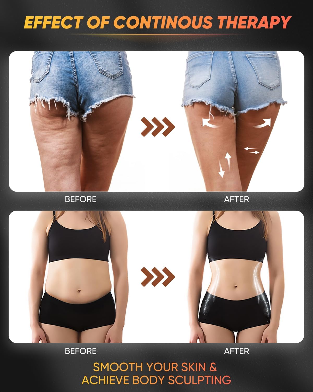 Herramientas de Masaje ONUEMP, Drenaje Linfático y Celulitis