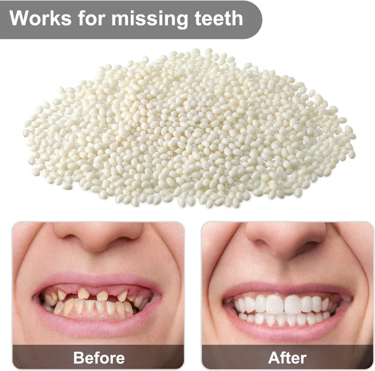 Repuesto de gel sólido moldeable para dientes falsos