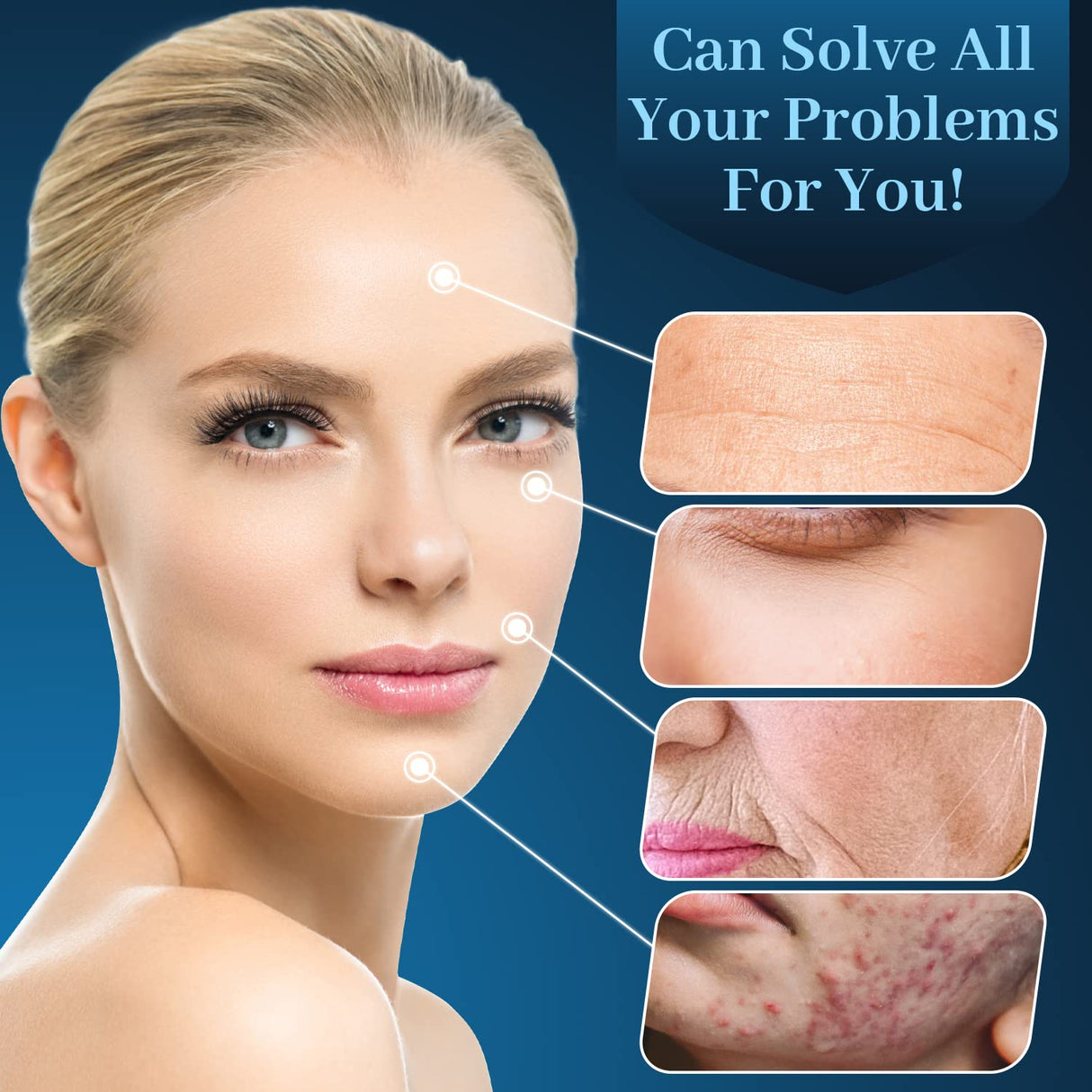 Varita Facial de Alta Frecuencia Portátil con 4 Tubos de Vidrio