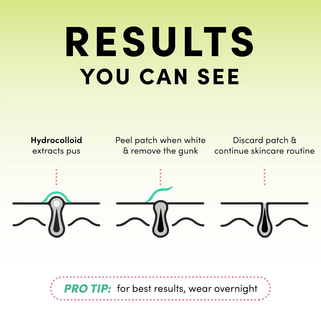 Parches de espinillas para cara paquete de 24 Dots for Spots