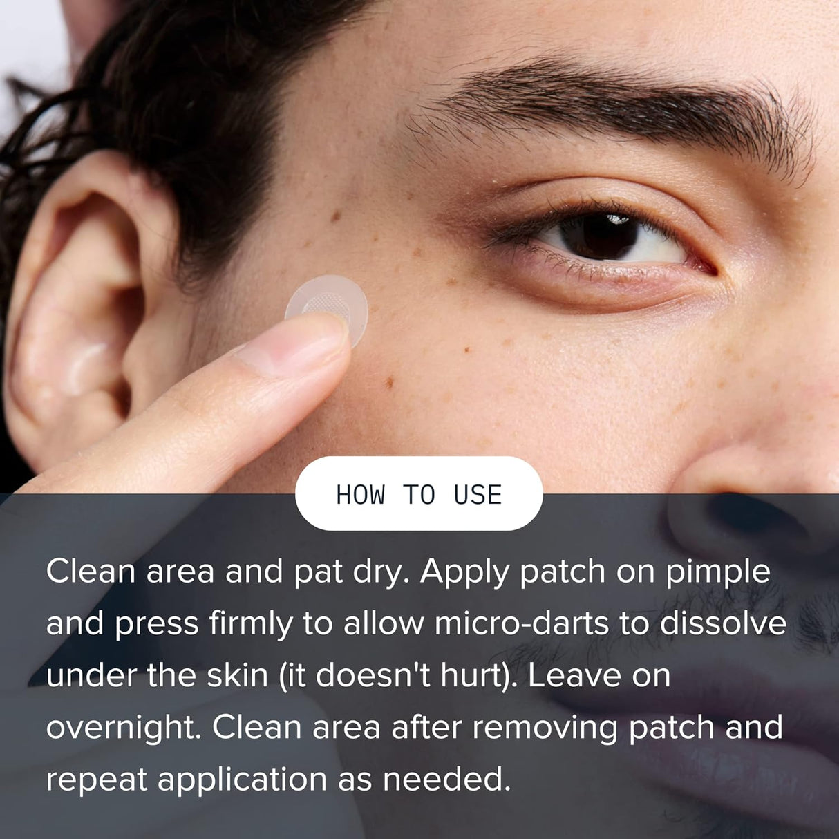 Cardon Parches de espinillas tratamiento acné puntos negros