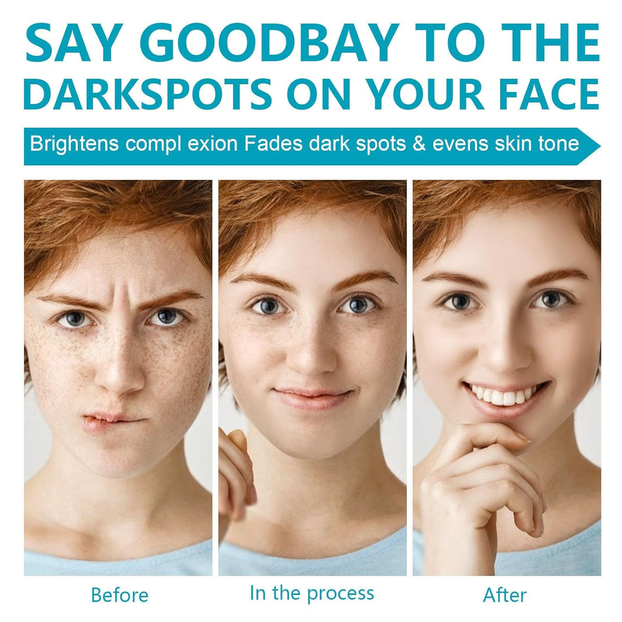 removedor de manchas oscuras para la cara Rosarden