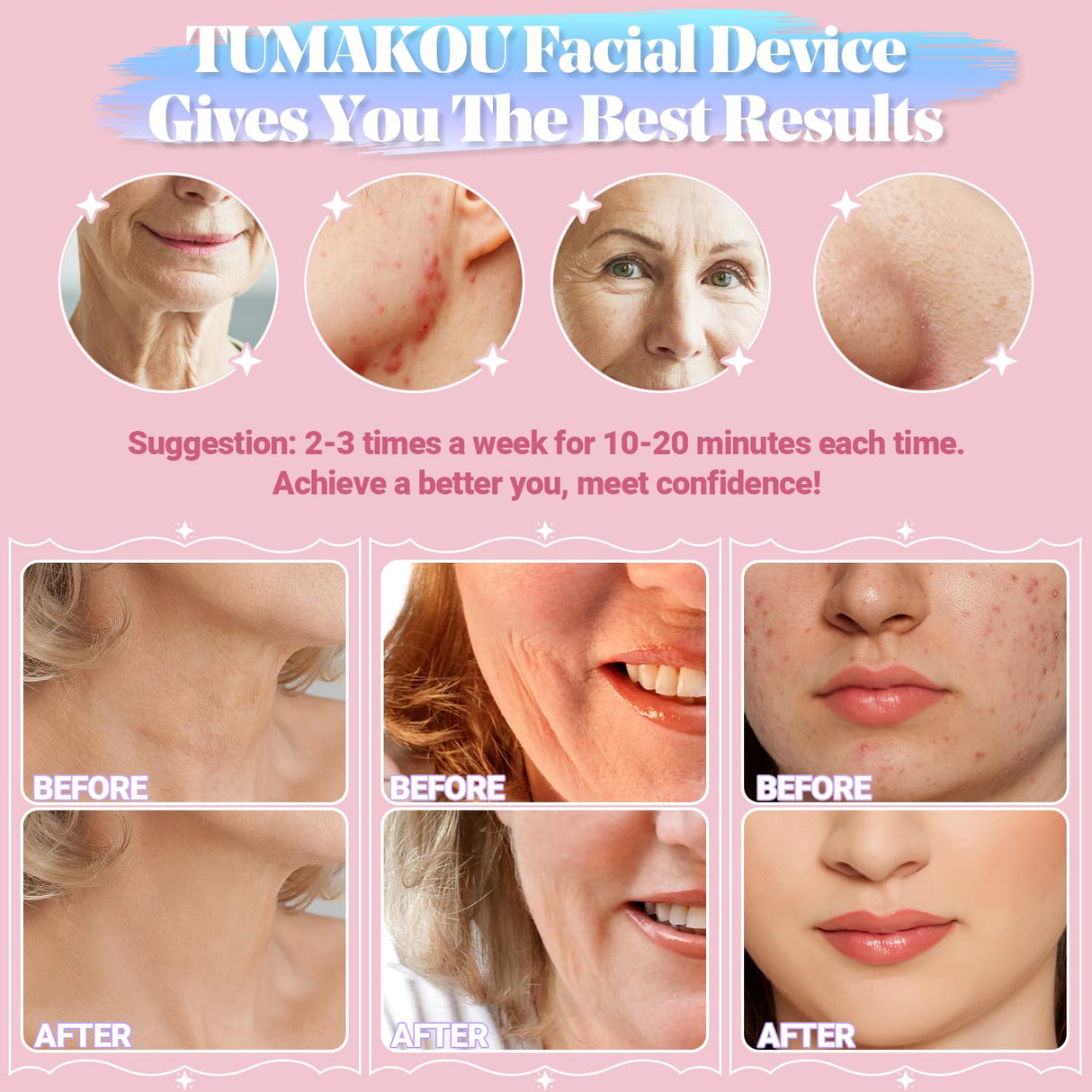 Máquina facial de alta frecuencia portátil con 6 tubos