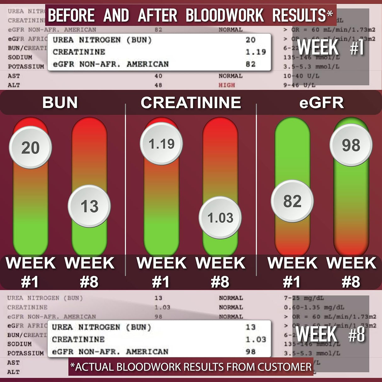 Suplementos óptima para la salud renal y la vesícula biliar |