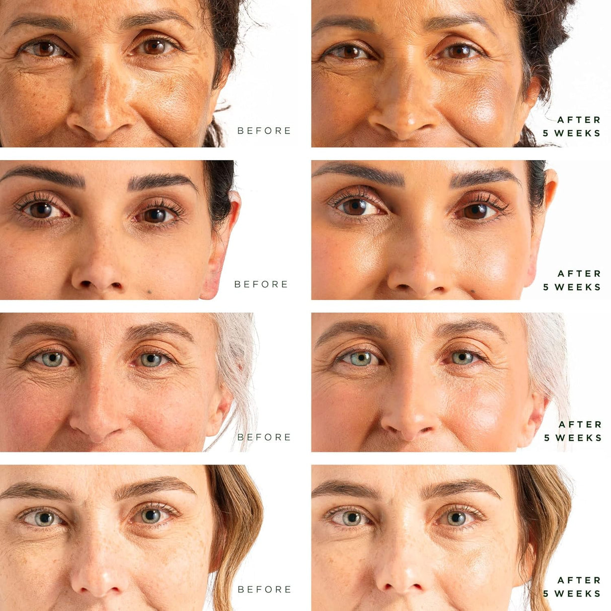 4 unidades x 1 fl oz Suero de cuidado facial