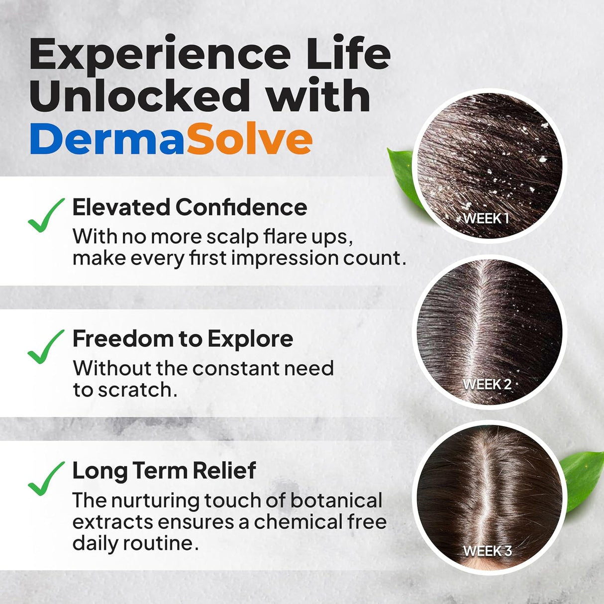 Dermasolve Aceite de cuero cabelludo para psoriasis