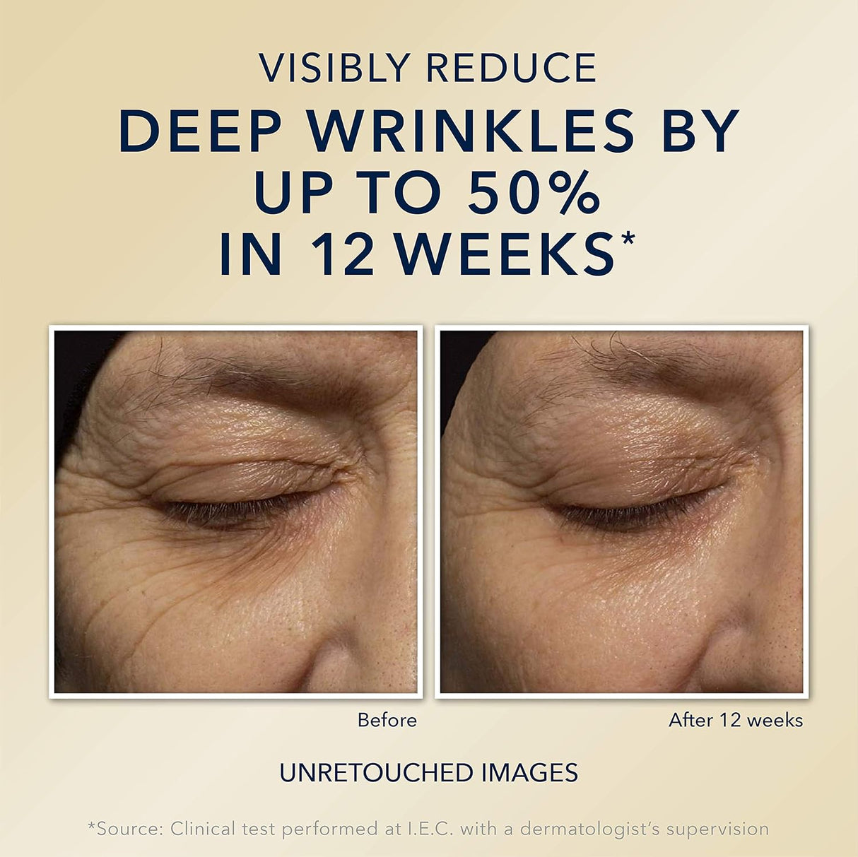 Retinol RoC Correcion de noche antienvejecimiento antiarruga