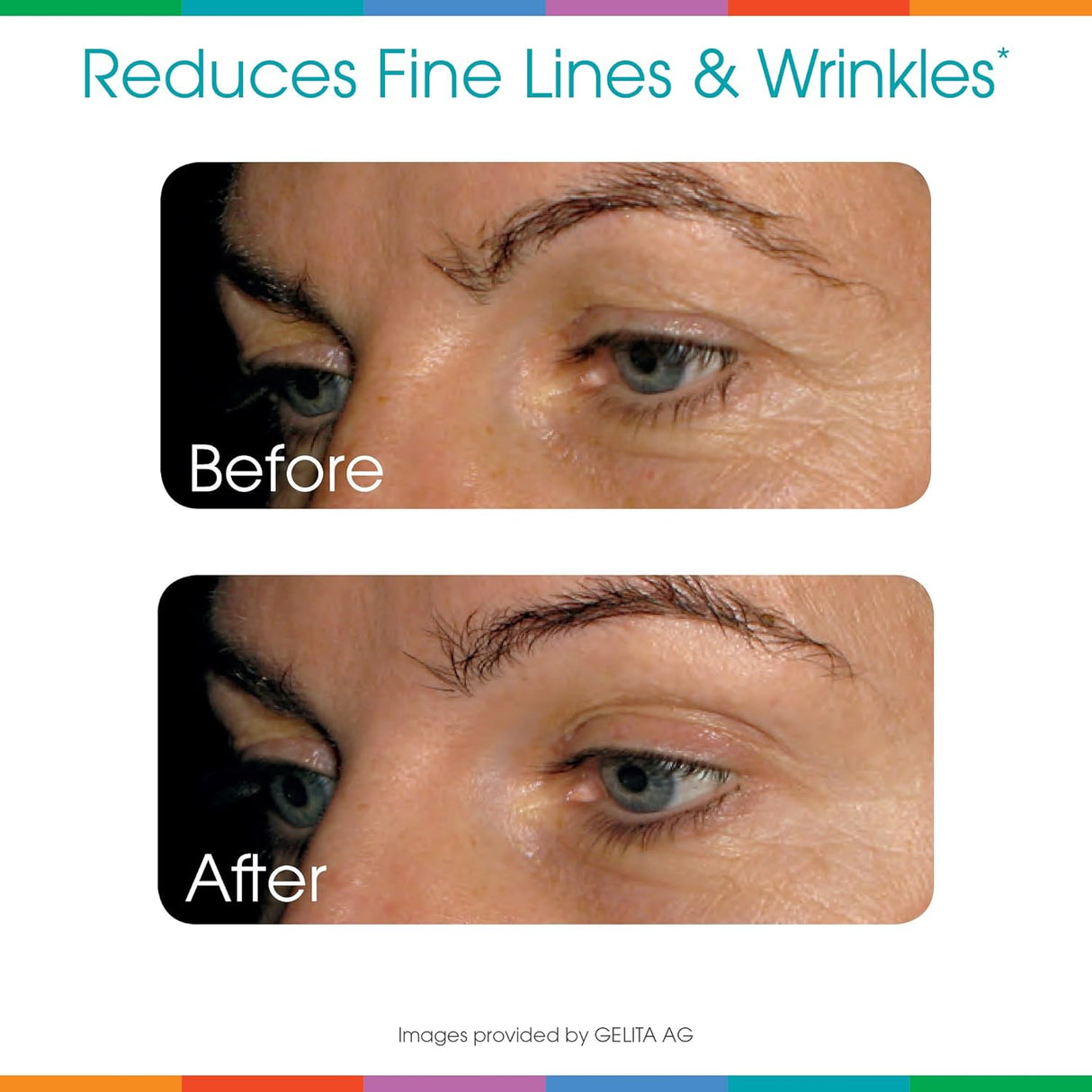 Suplemento alimenticio para mejorar la piel en polvo