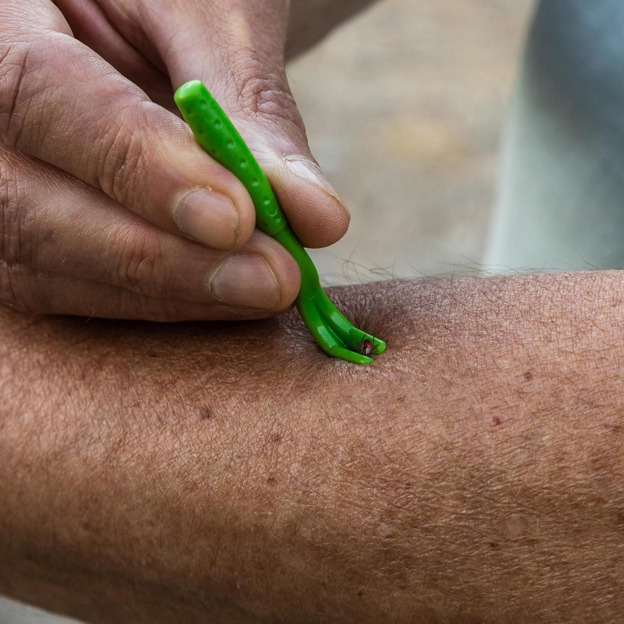 Juego de 3 Removedores de Garrapatas - Herramientas + Tarjeta