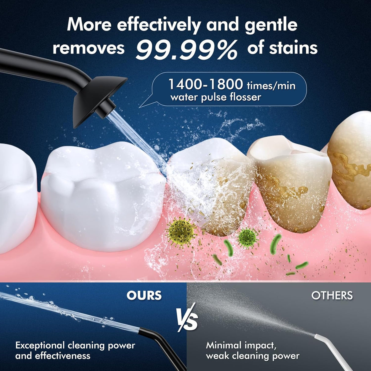 Irrigador Dental Inalámbrico IPX7 con 3 Modos y 5 Puntas