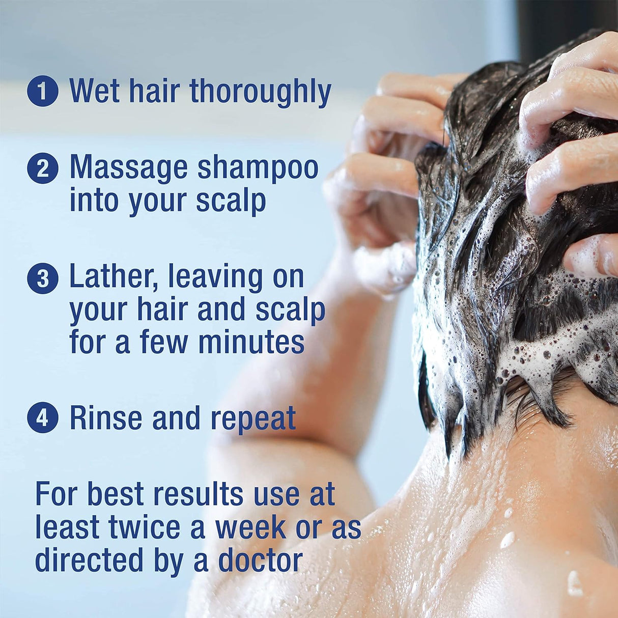 Acumulación del cuero cabelludo con ácido salicílico.