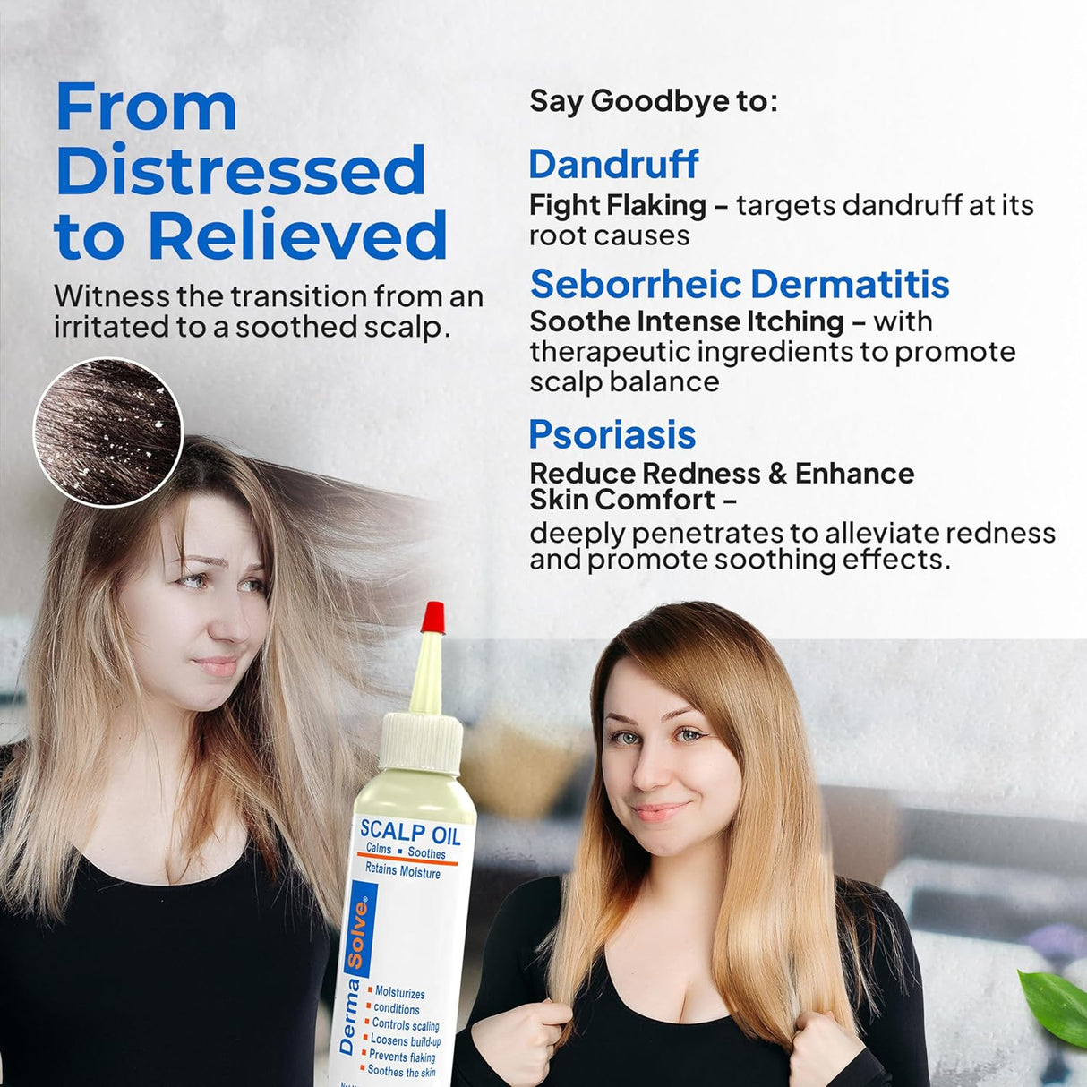 Dermasolve Aceite de cuero cabelludo para psoriasis