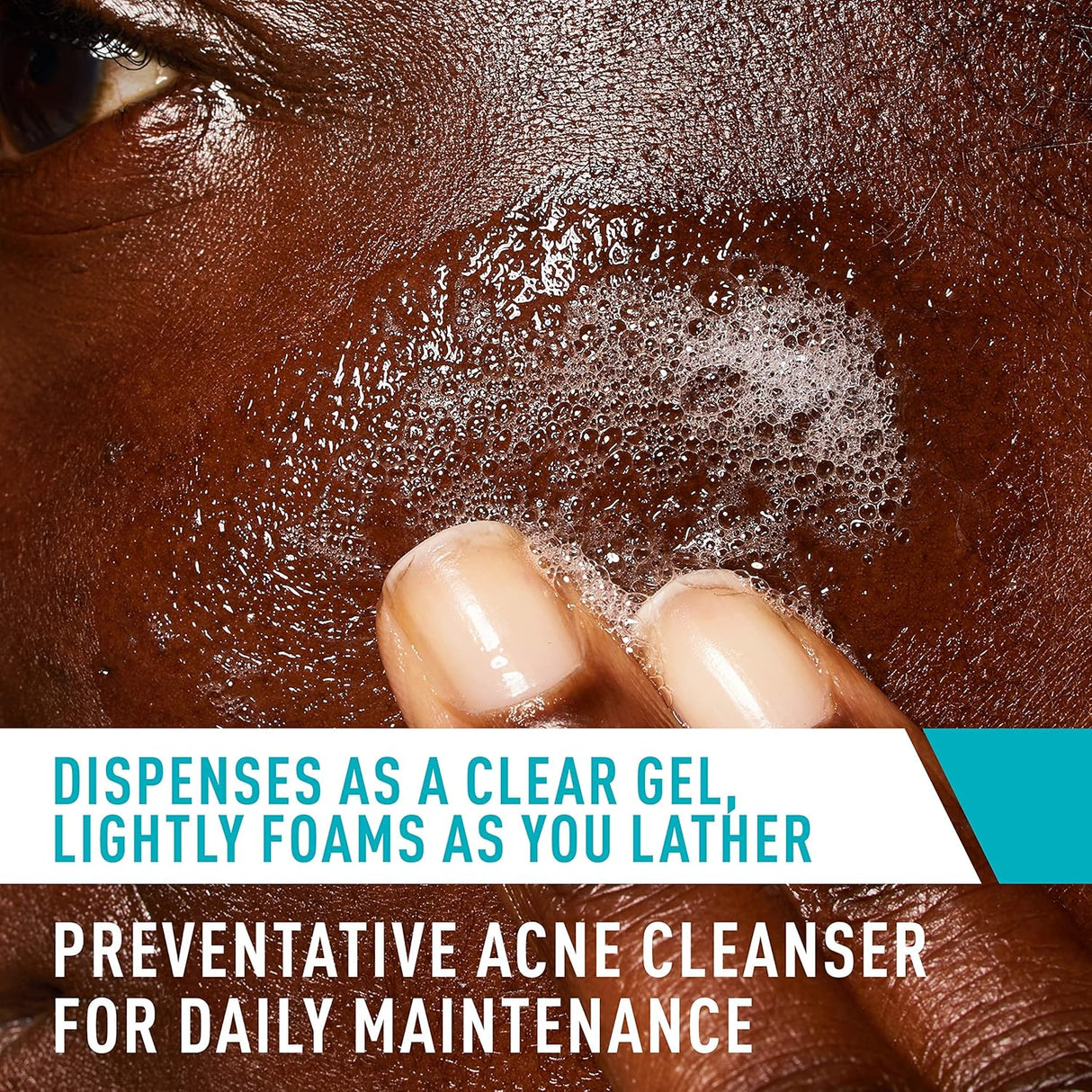 Limpiador Facial para Acné | Ácido Salicílico y Arcilla Purificante