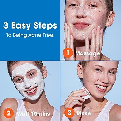 Mascarilla De Azufre Sin Acné 1.7 Oz Tratamiento Para El