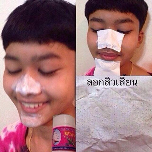 3 juegos X Blackhead Whitehead Espinilla Eliminador De Acné