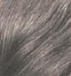 Corrector de pérdida de cabello