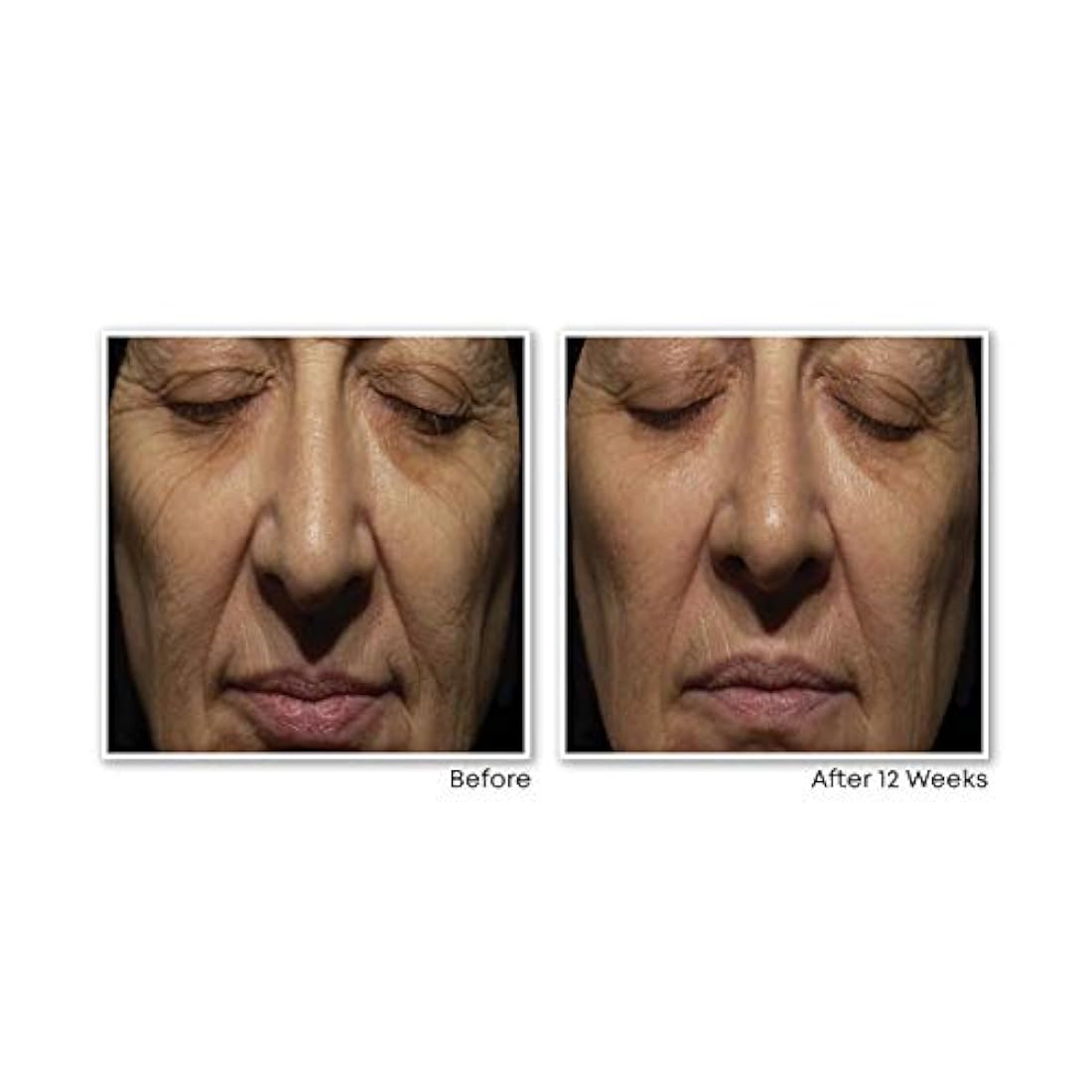 RoC Retinol Correxion Rellenador facial de arrugas profundas