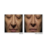 RoC Retinol Correxion Rellenador facial de arrugas profundas