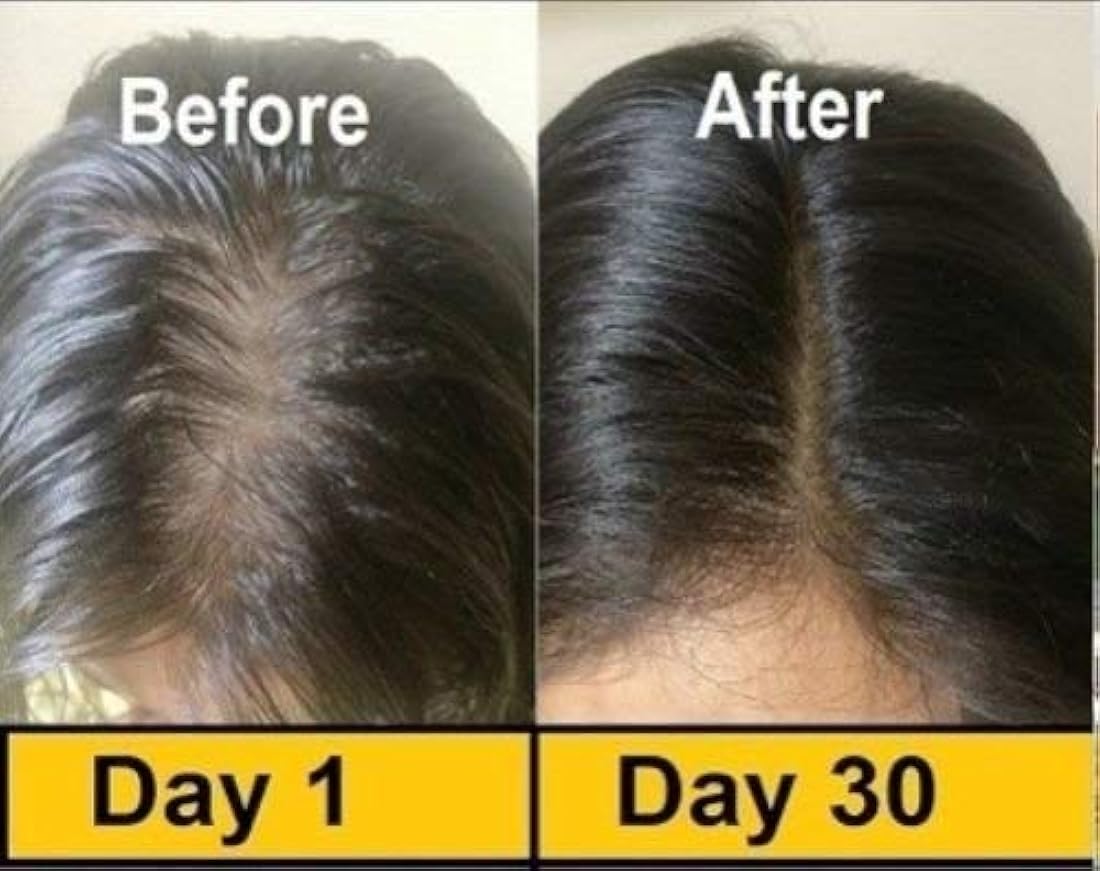 50 cápsulas de Evion Vitamina E para la cara que brilla intensamente, cabello fuerte, acné, uñas, piel brillante 400mg