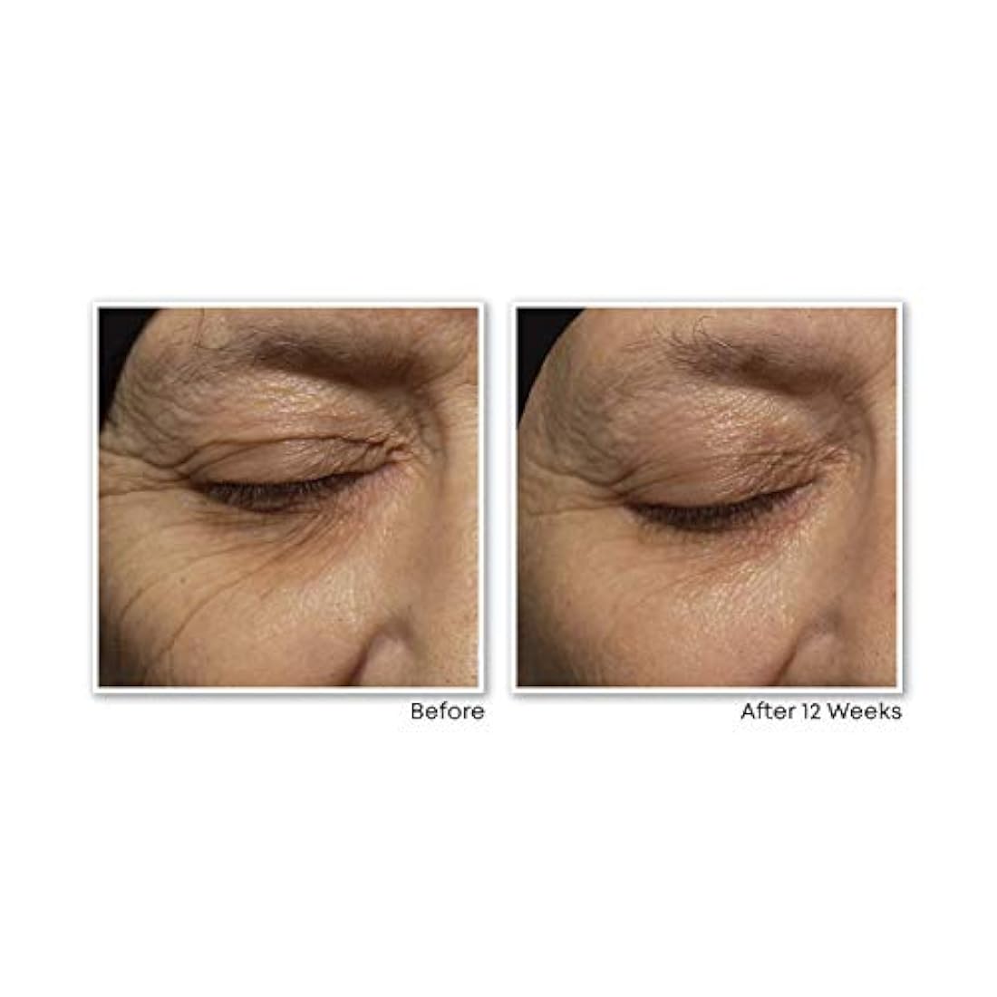 RoC Retinol Correxion Rellenador facial de arrugas profundas