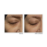 RoC Retinol Correxion Rellenador facial de arrugas profundas