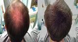 Luxe Thickening de pelo fibras con Queratina Natural – 2 Meses suministro de confianza en un frasco. Múltiples Colores disponibles., Café Oscuro