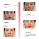 Rose Face Serum, BREYLEE Serum hidratante esencia de rosa