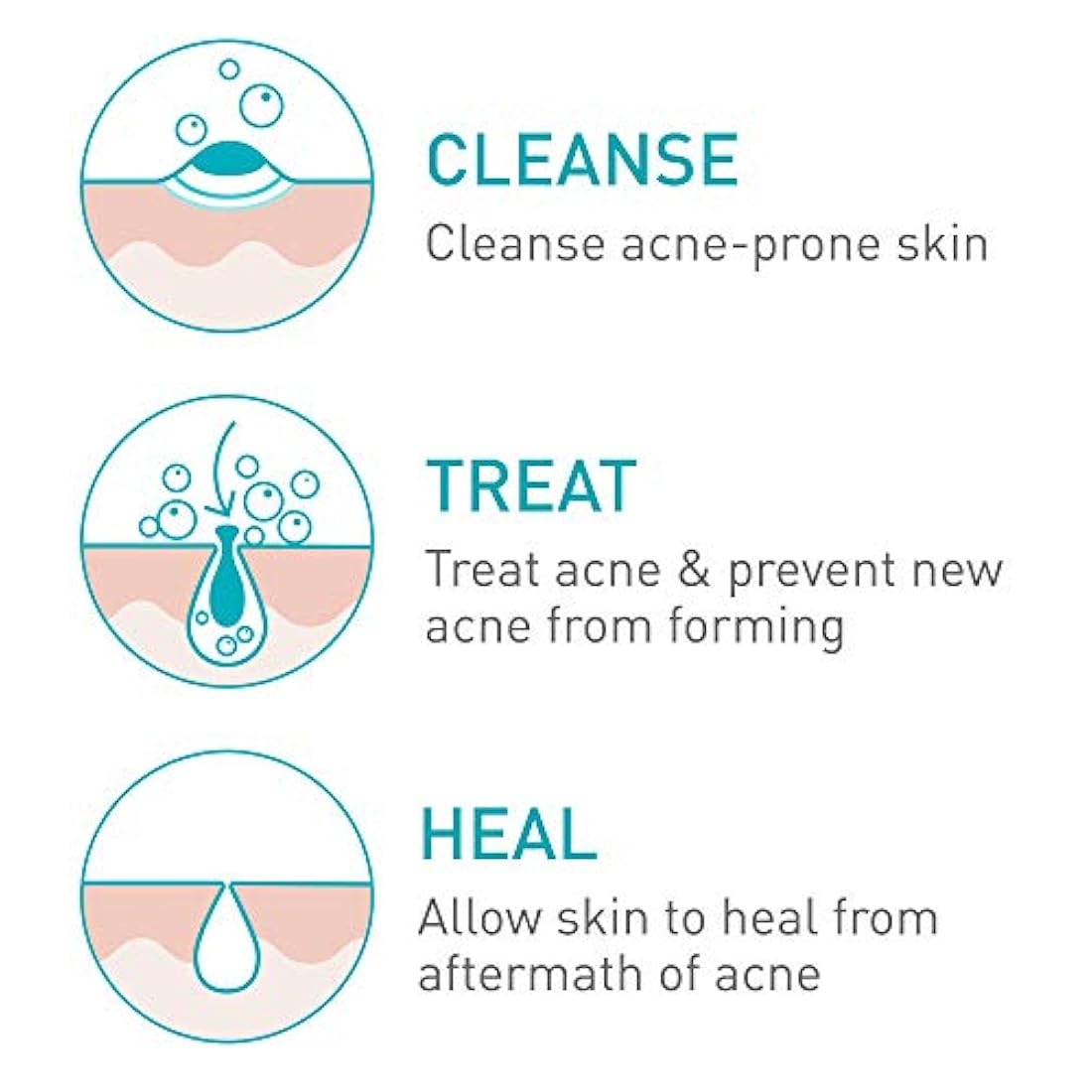 Limpiador de crema espumante para acné para piel sensible