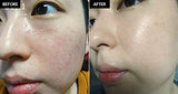 Crema para las manchas faciales