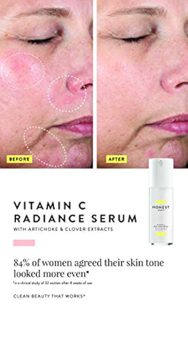 Honest Beauty - Suero radiante de vitamina C con extractos