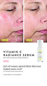 Honest Beauty - Suero radiante de vitamina C con extractos