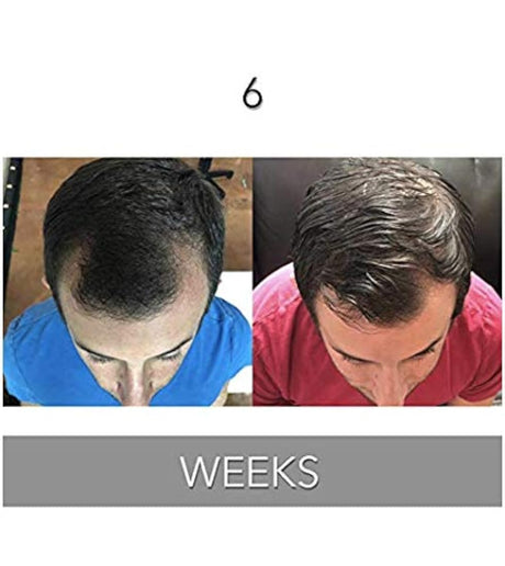 Biotin Vitamina Champú y acondicionador para crecimiento