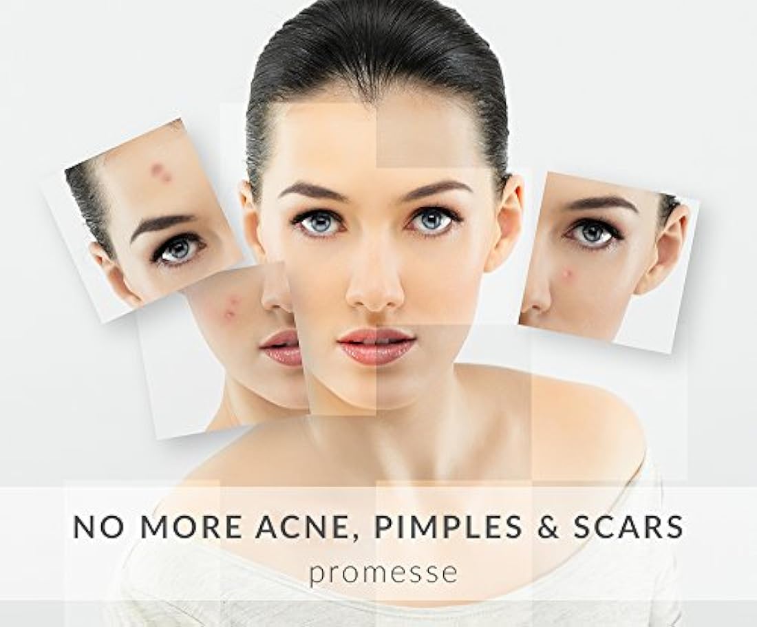 Promesse - Limpiador facial profesional para pieles grasas