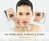 Promesse - Limpiador facial profesional para pieles grasas