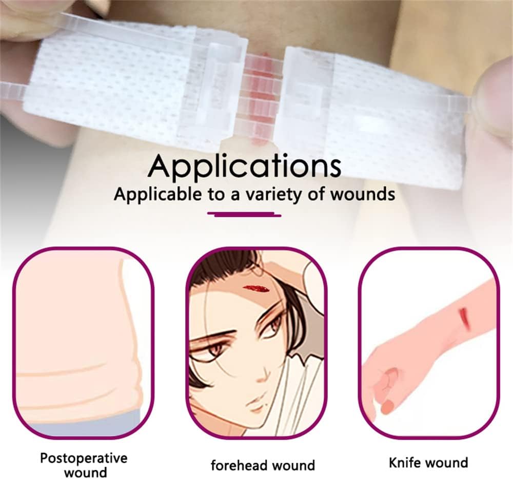 Kit de Cierre de Heridas Sin Puntos, 2 Pcs, Zip Stitch
