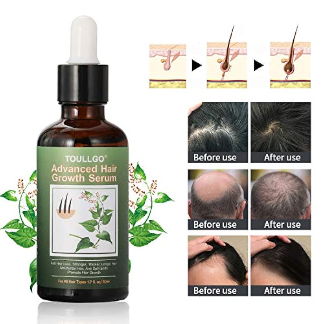Suero para el crecimiento del cabello, tratamientos