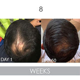 Biotin Vitamina Champú y acondicionador para crecimiento
