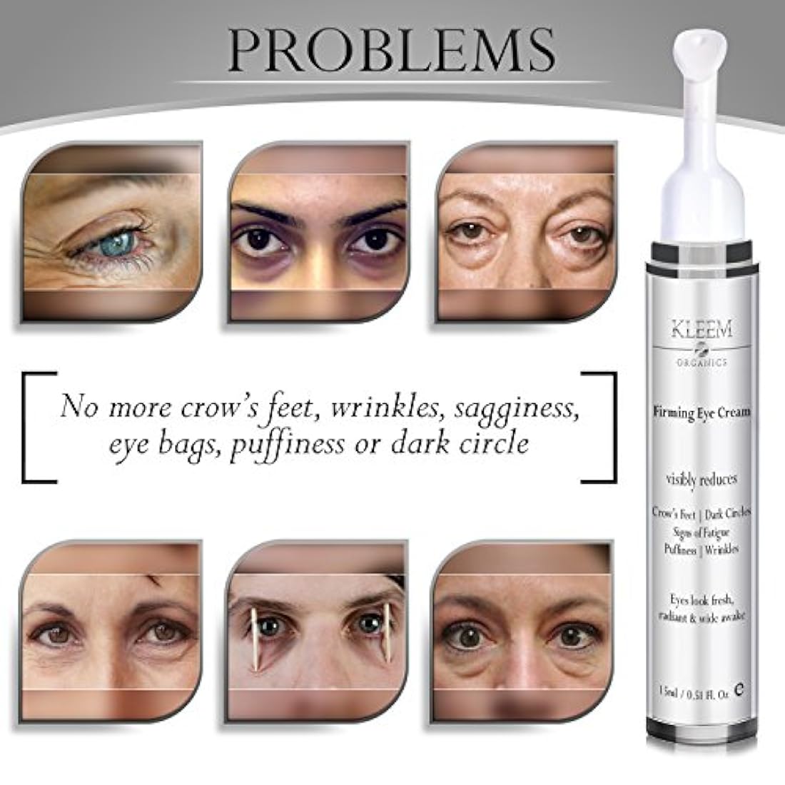 Nueva crema antienvejecimiento para ojeras para círculos
