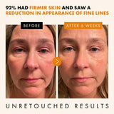 Suero facial de vitamina C y ácido hialurónico Eclat Skincare
