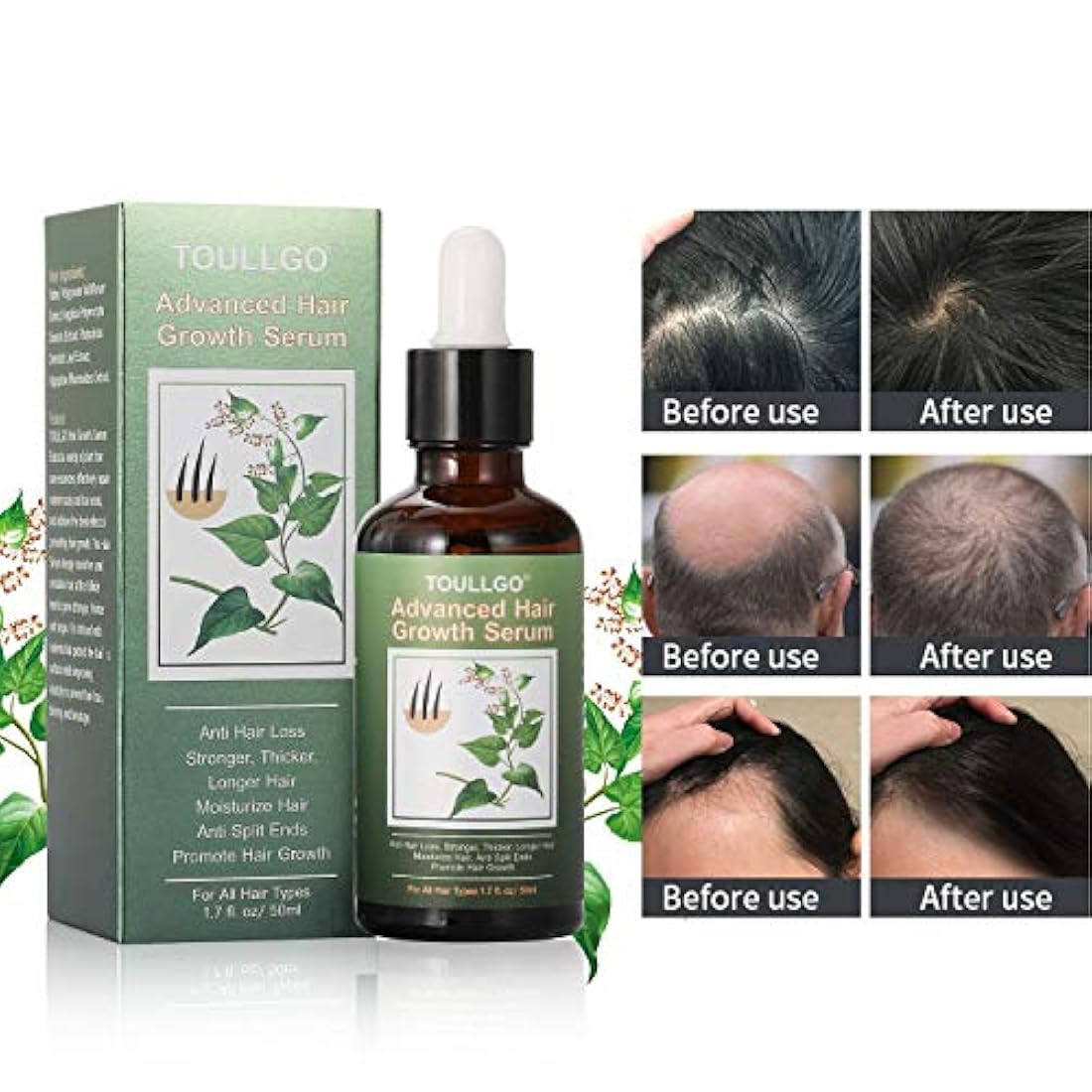 Suero para el crecimiento del cabello, tratamientos