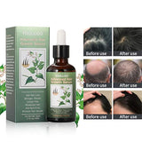 Suero para el crecimiento del cabello, tratamientos