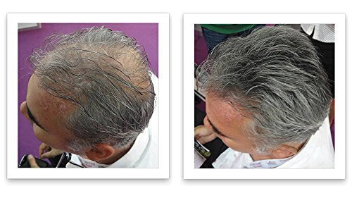Corrector de pérdida de cabello marrón mediano