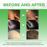 Fórmula tópica avanzada para crecimiento del cabello