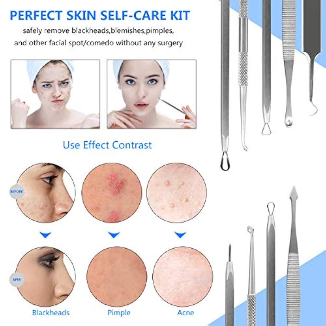 Kits de herramientas de extractor de puntos negros