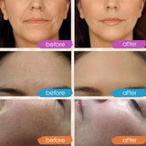 Suero Facial de Retinol y Ácido Hialurónico Hidratante Nocturno