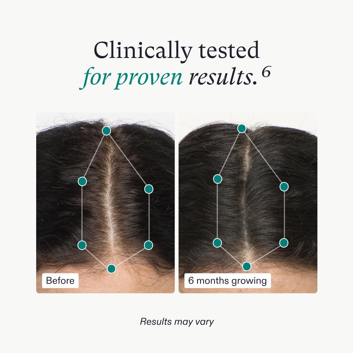 Suplementos para el crecimiento del cabello para mujeres 18-44