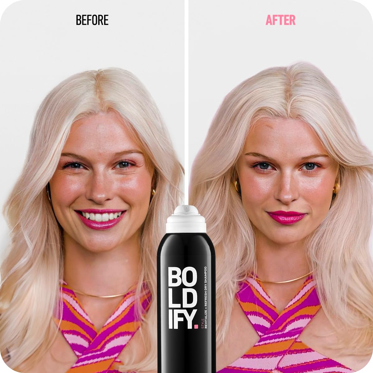 Shampoo en aerosol seco para mujeres y hombres Boldify